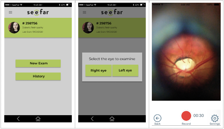 See Far App for disease detection and monitoring services